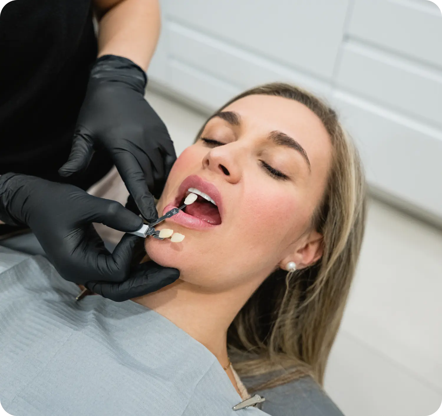 Servicio Estética Dental